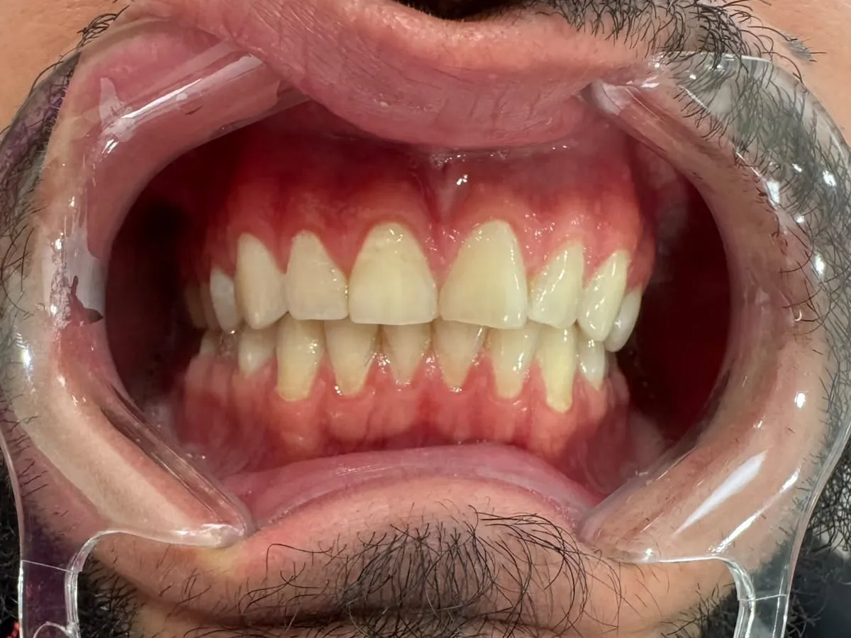 Before: Case 2